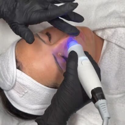 Laser Haarentfernung Wimpern Kosmetik