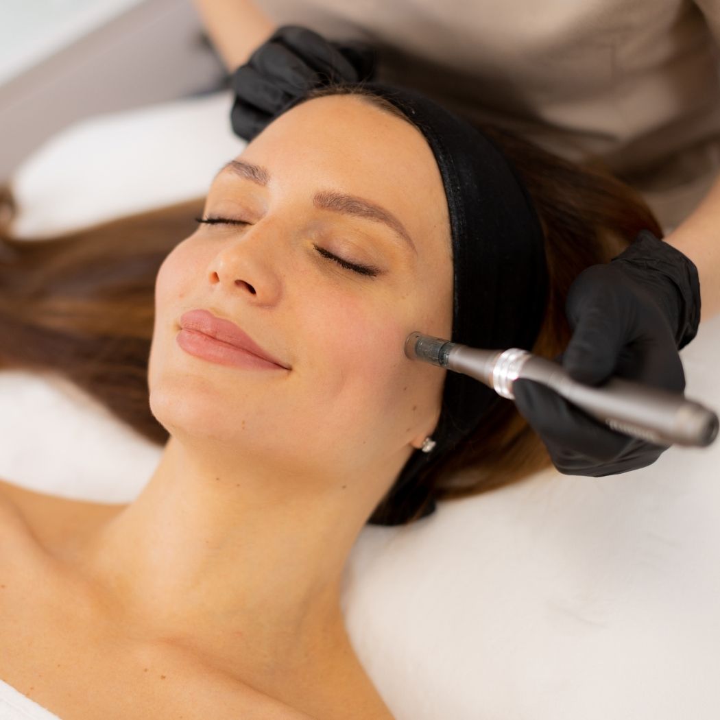 Microneedling Kosmetik pureaesthetics